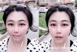 娱乐吃瓜酱鼻梁变高,揭秘明星整形新趋势